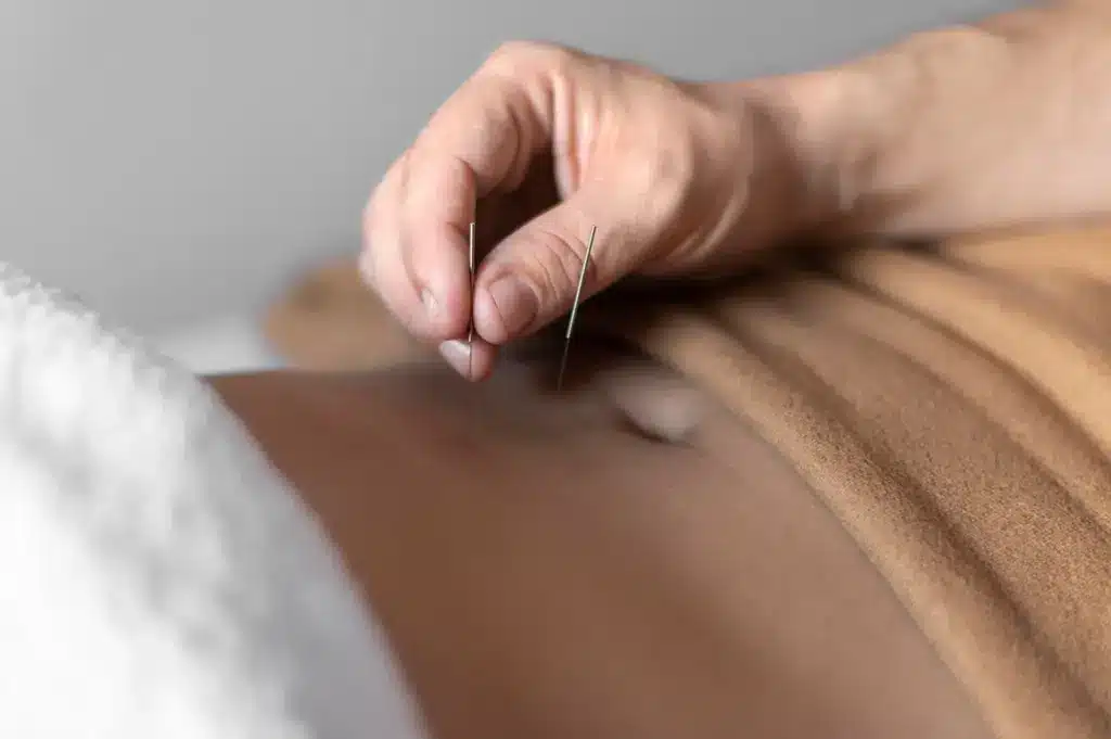 Trigger Point Therapy